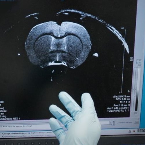 Image of  Biolääketieteellinen MRI