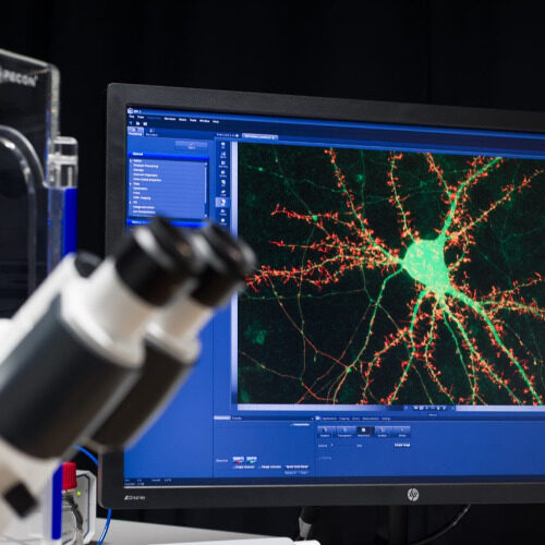 Alzheimerin taudin molekyyligenetiikka - Hiltunen Lab profiilikuva