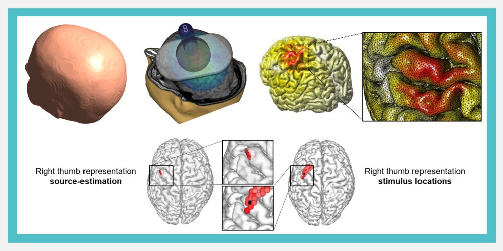 Esittelykuva ryhmästä Neuromodulaatiotutkimusryhmä