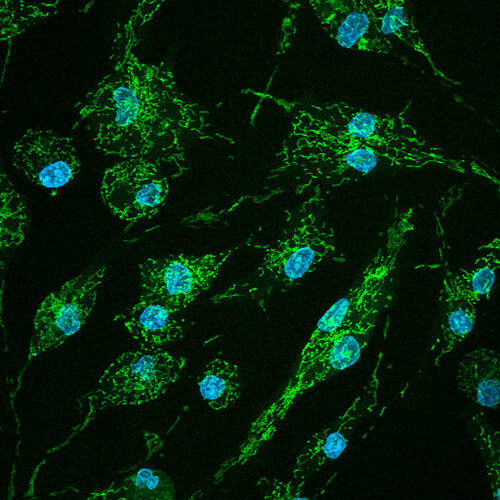 Neuroinflammation research group profiilikuva